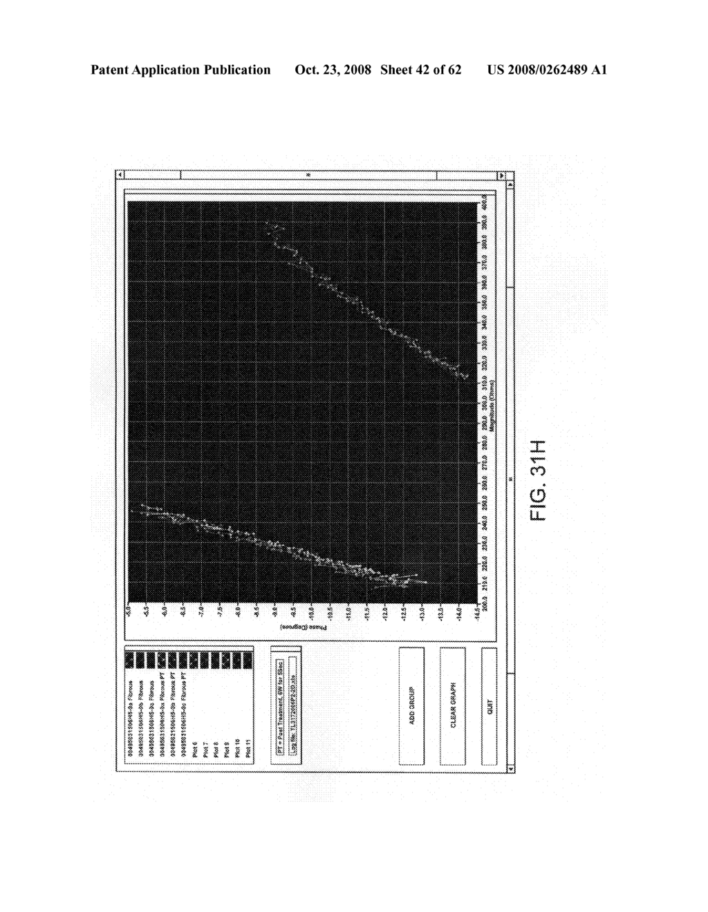 Thrombus removal - diagram, schematic, and image 43