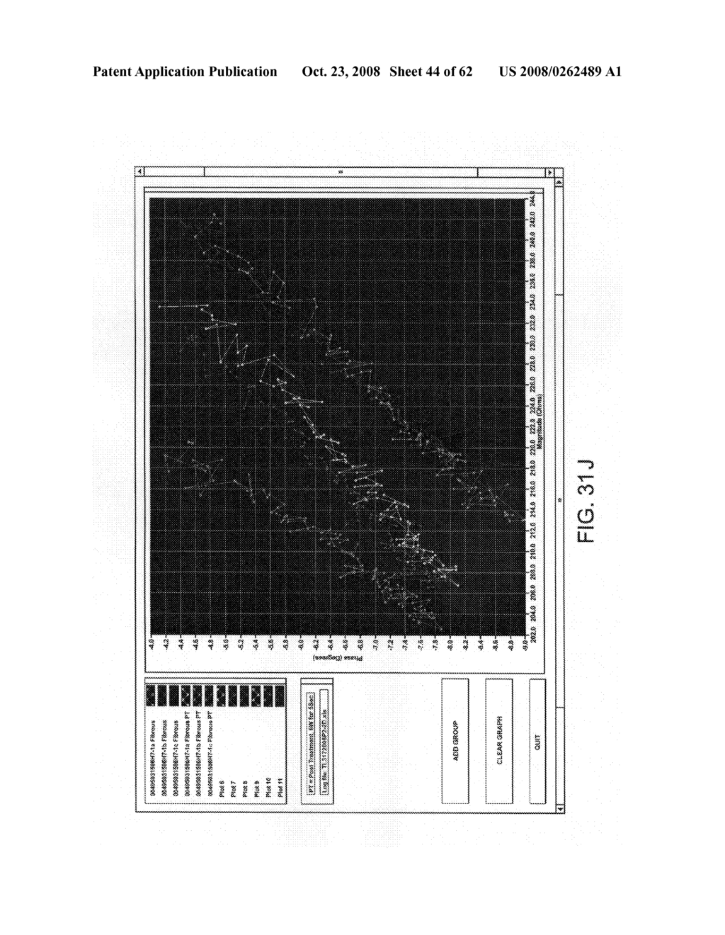 Thrombus removal - diagram, schematic, and image 45