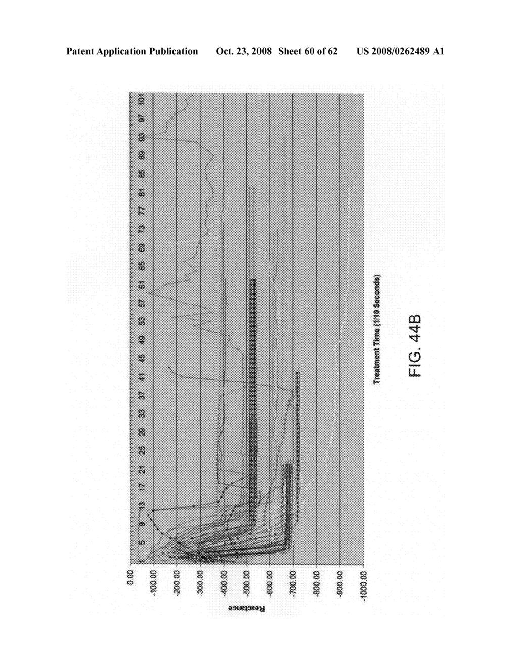 Thrombus removal - diagram, schematic, and image 61