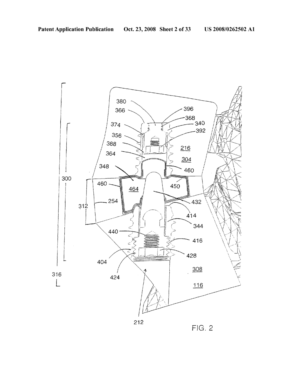 MULTI-MEMBRANE PROSTHETIC NUCLEUS - diagram, schematic, and image 03