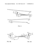 Disposable Iontophoresis System and Tympanic Membrane Pain Inhibition Method diagram and image