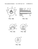 Disposable Iontophoresis System and Tympanic Membrane Pain Inhibition Method diagram and image