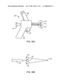 Disposable Iontophoresis System and Tympanic Membrane Pain Inhibition Method diagram and image