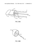 Disposable Iontophoresis System and Tympanic Membrane Pain Inhibition Method diagram and image