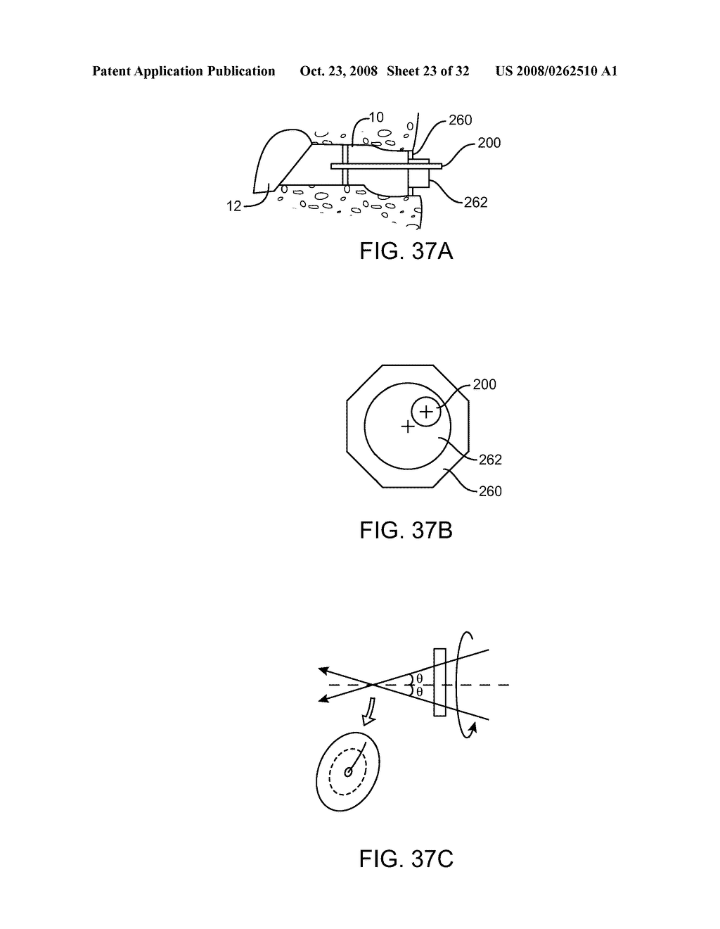 Disposable Iontophoresis System and Tympanic Membrane Pain Inhibition Method - diagram, schematic, and image 24