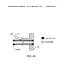 Disposable Iontophoresis System and Tympanic Membrane Pain Inhibition Method diagram and image