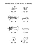 Disposable Iontophoresis System and Tympanic Membrane Pain Inhibition Method diagram and image