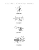 Disposable Iontophoresis System and Tympanic Membrane Pain Inhibition Method diagram and image