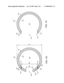 Anoscope for Inspection and/or Surgery diagram and image