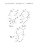 Devices and methods for treatment of obesity diagram and image