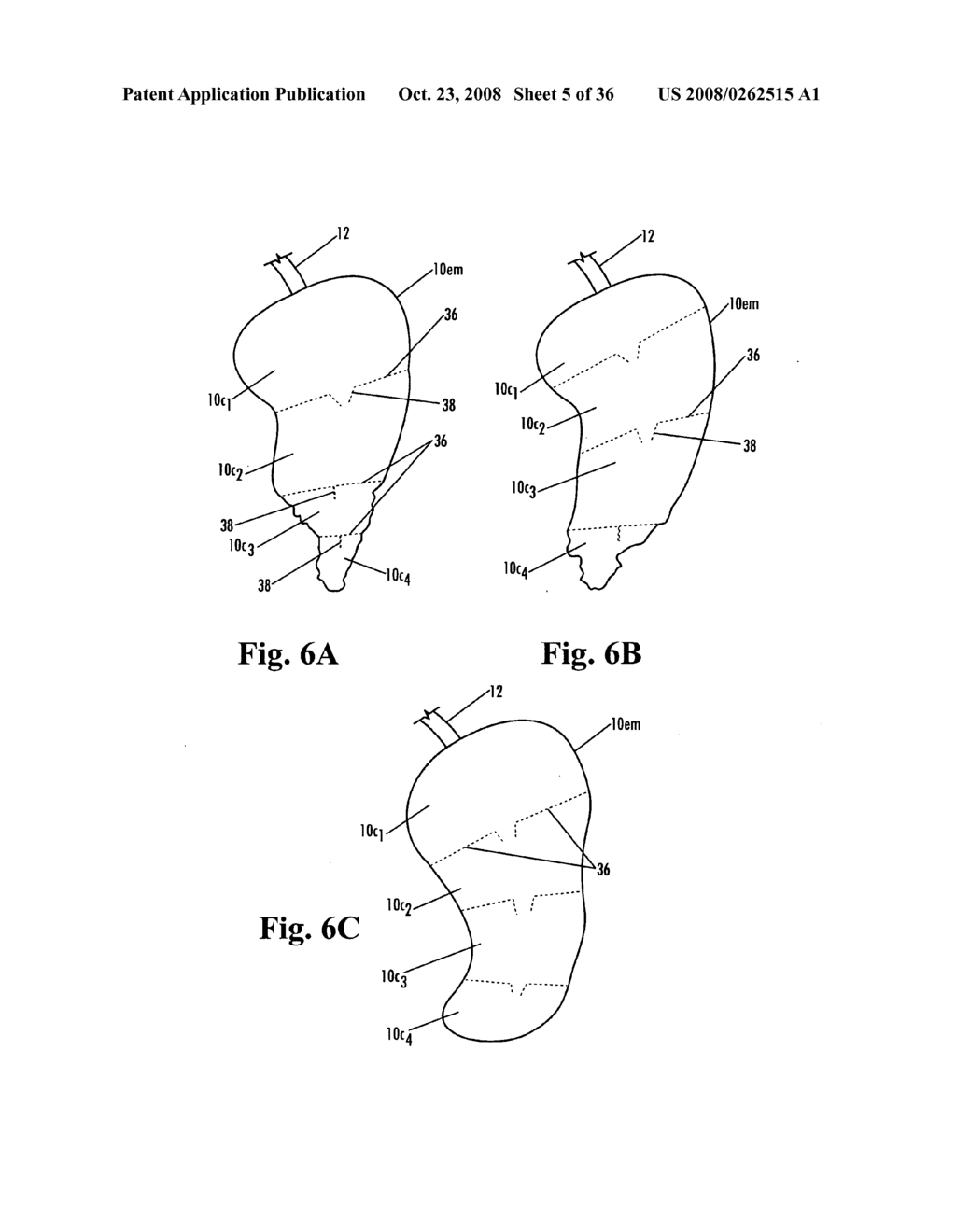 Devices and methods for treatment of obesity - diagram, schematic, and image 06