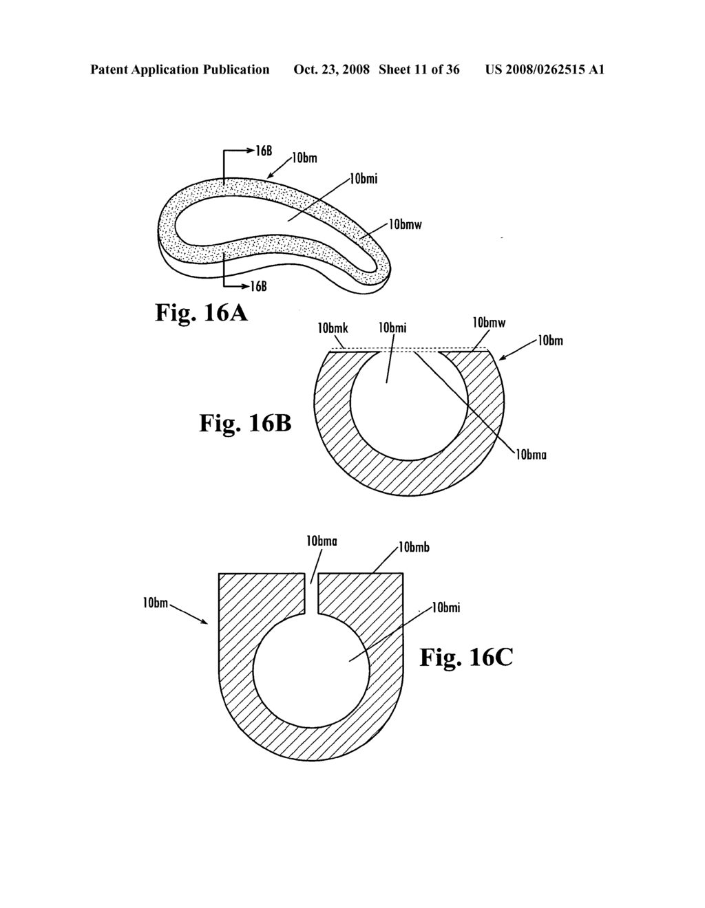 Devices and methods for treatment of obesity - diagram, schematic, and image 12