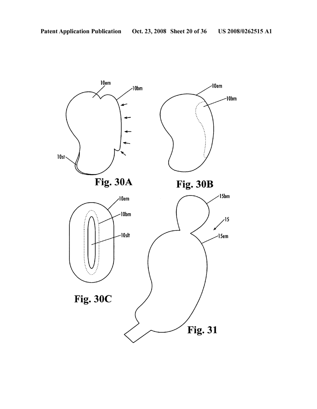 Devices and methods for treatment of obesity - diagram, schematic, and image 21