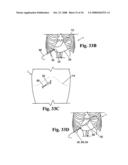 Devices and methods for treatment of obesity diagram and image