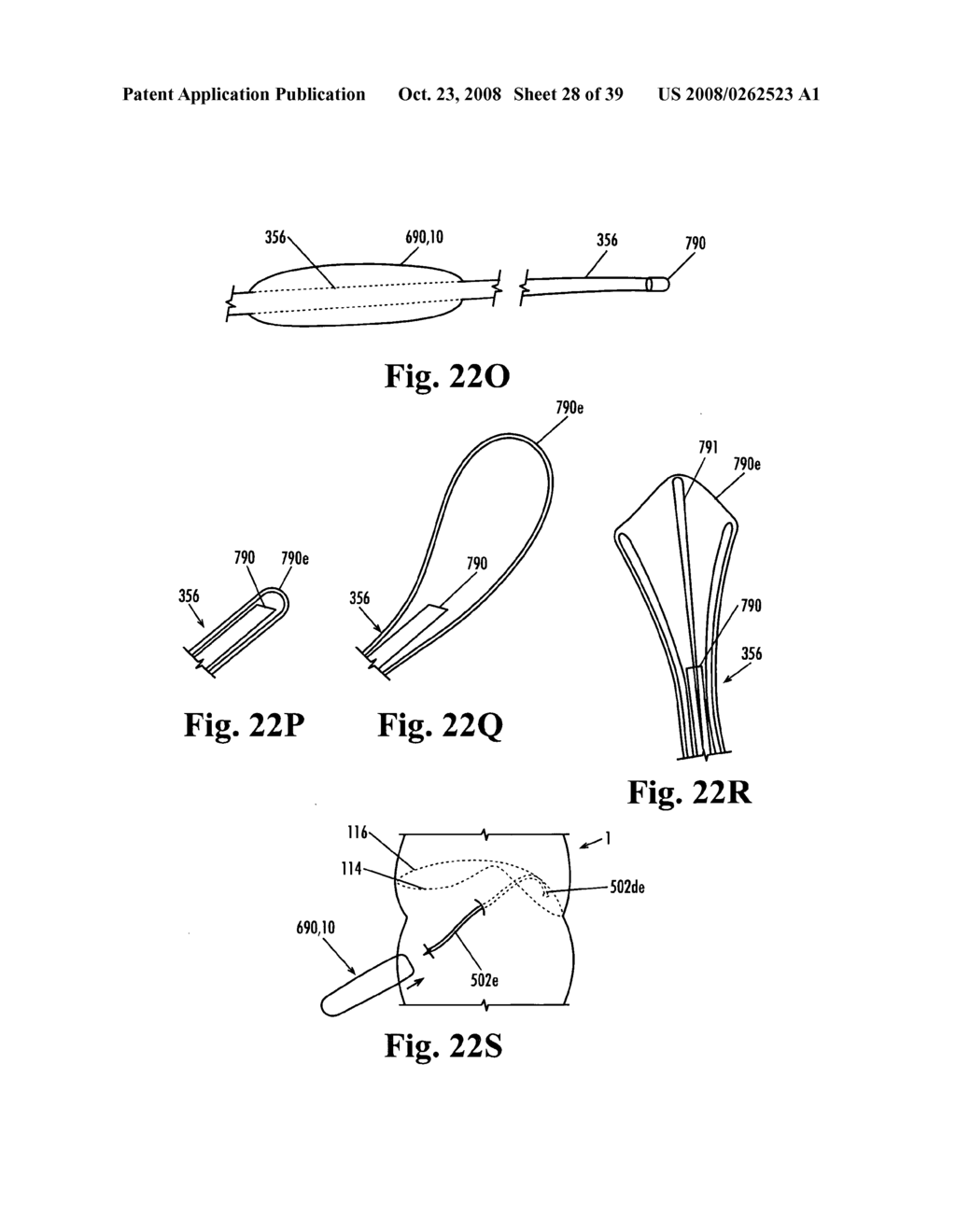 Devices and methods for treatment of obesity - diagram, schematic, and image 29