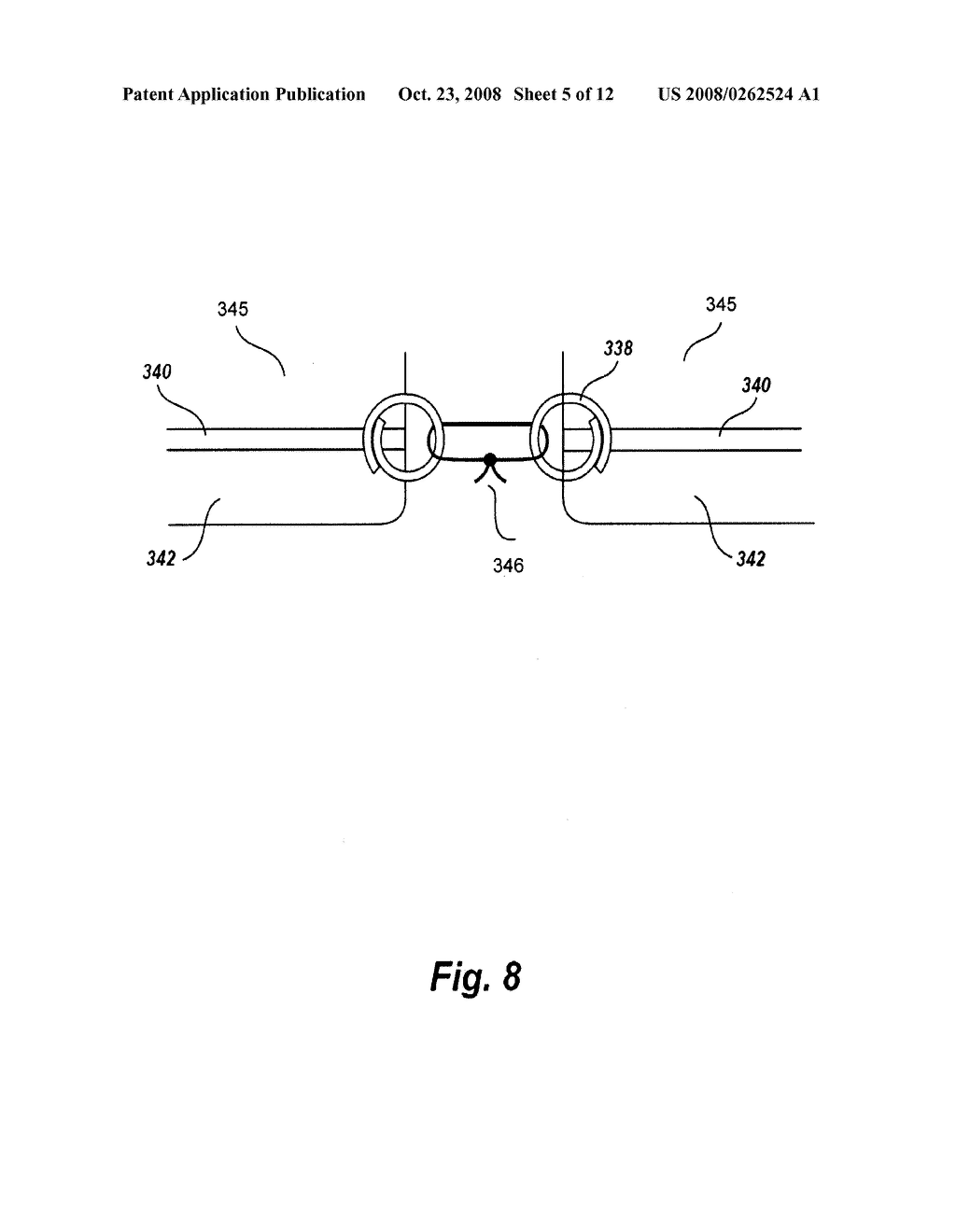 Systems and methods for closing of fascia - diagram, schematic, and image 06