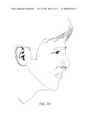 NASAL INSERTS diagram and image