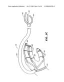 ARTICULATING INSTRUMENT diagram and image