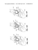 ARTICULATING INSTRUMENT diagram and image