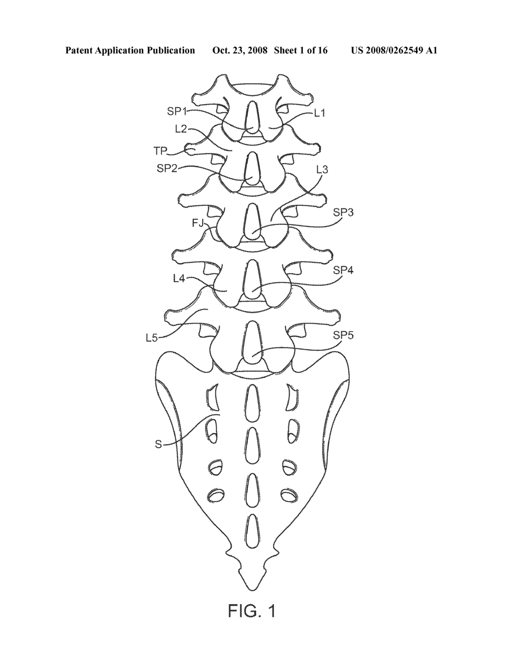 METHODS AND SYSTEMS FOR DEPLOYING SPINOUS PROCESS CONSTRAINTS - diagram, schematic, and image 02