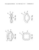 Dyanamic rod diagram and image