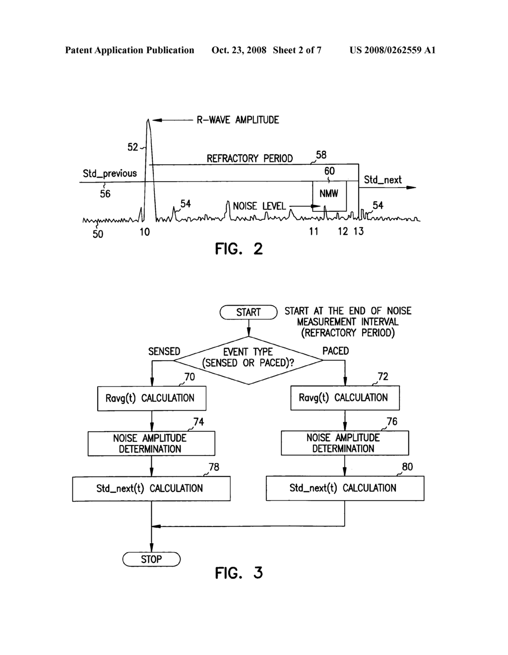 Method and apparatus for adjusting the sensing threshold of a cardiac rhythm management device - diagram, schematic, and image 03