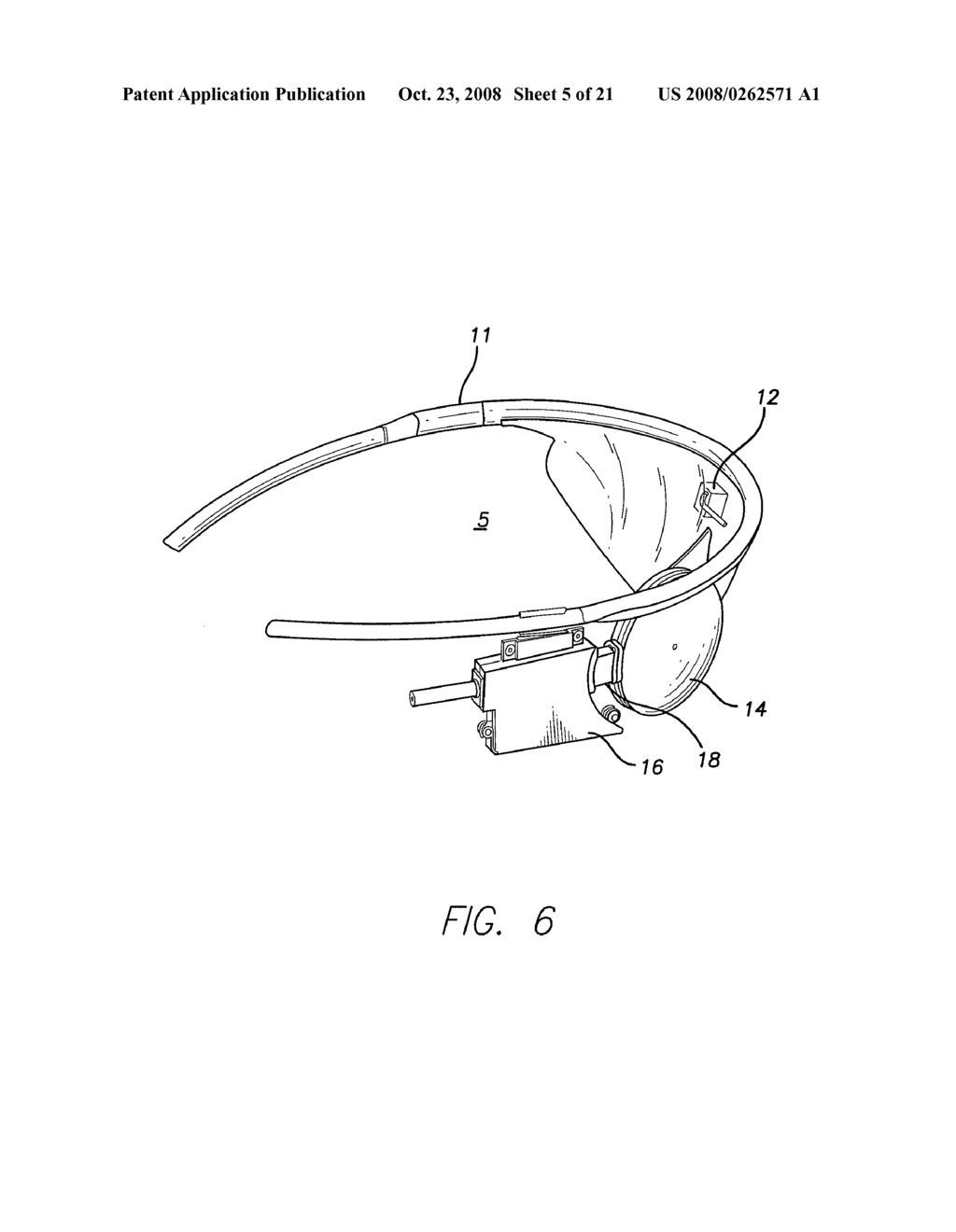 Visual Prosthesis - diagram, schematic, and image 06