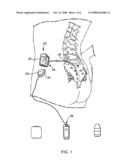 HEATING IMPLANTABLE DEVICE TO TREAT A CONDITION diagram and image