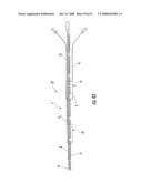 METHODS AND APPARATUS FOR FABRICATING LEADS WITH CONDUCTORS AND RELATED FLEXIBLE LEAD CONFIGURATIONS diagram and image