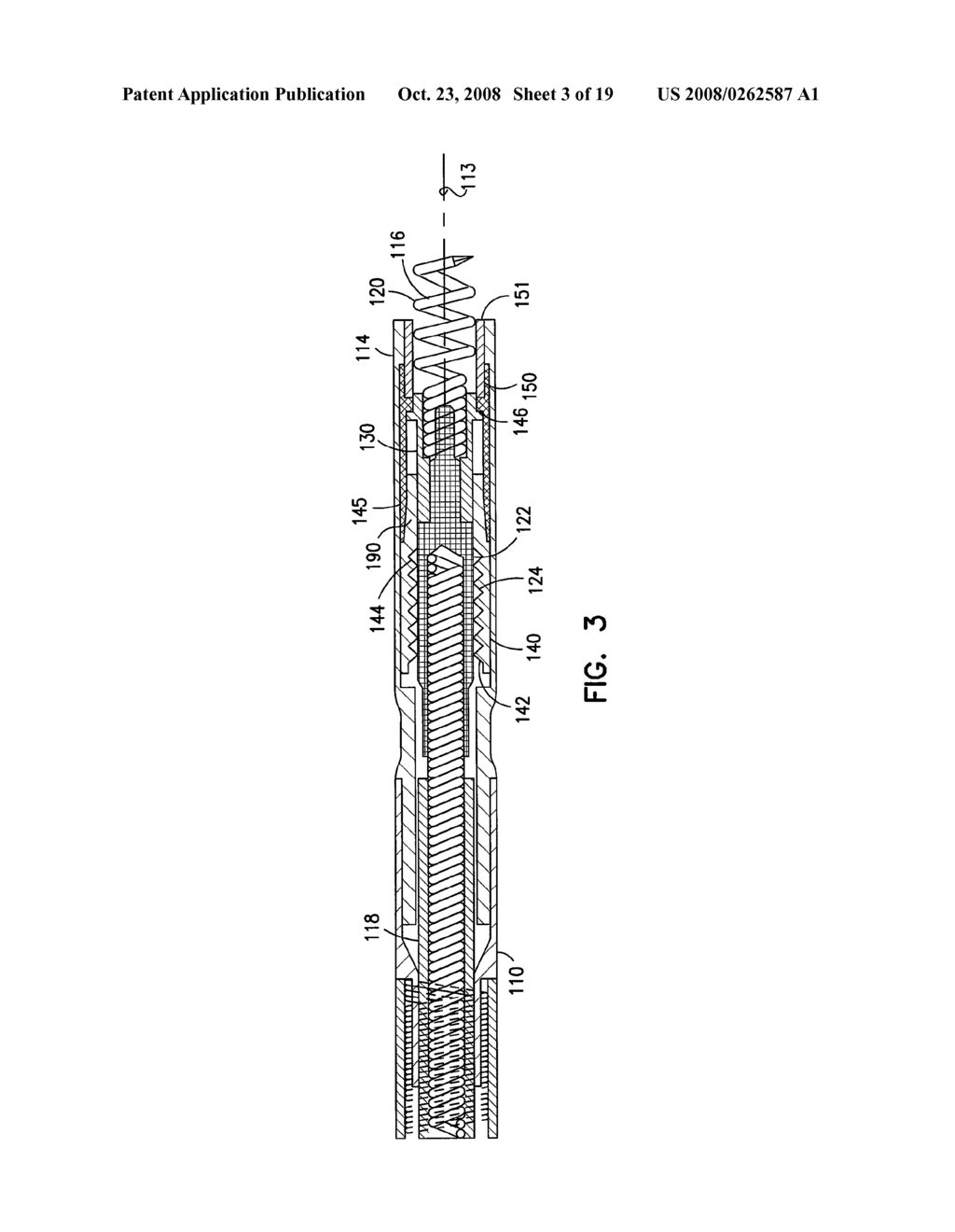 EXTENDABLE AND RETRACTABLE LEAD HAVING A SNAP-FIT TERMINAL CONNECTOR - diagram, schematic, and image 04