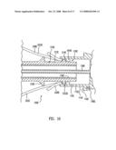 Delivery System for Stent-Graft diagram and image