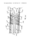 Delivery System for Stent-Graft diagram and image