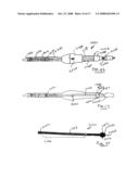 Delivery System for Stent-Graft diagram and image