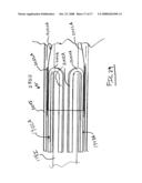 Delivery System for Stent-Graft diagram and image