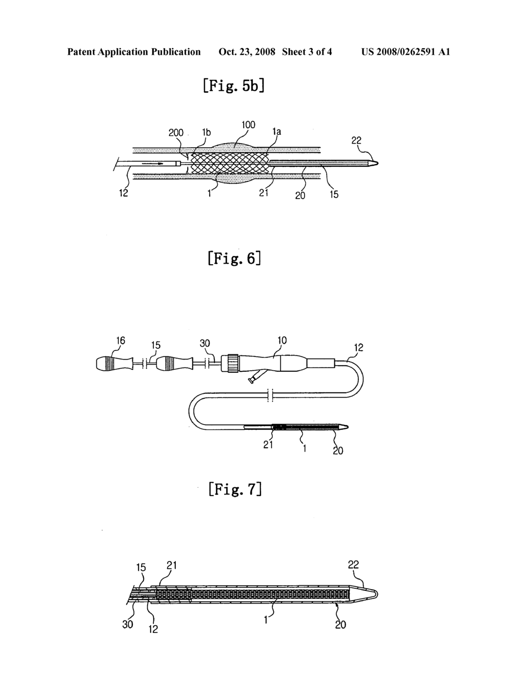 Stent inserting device - diagram, schematic, and image 04