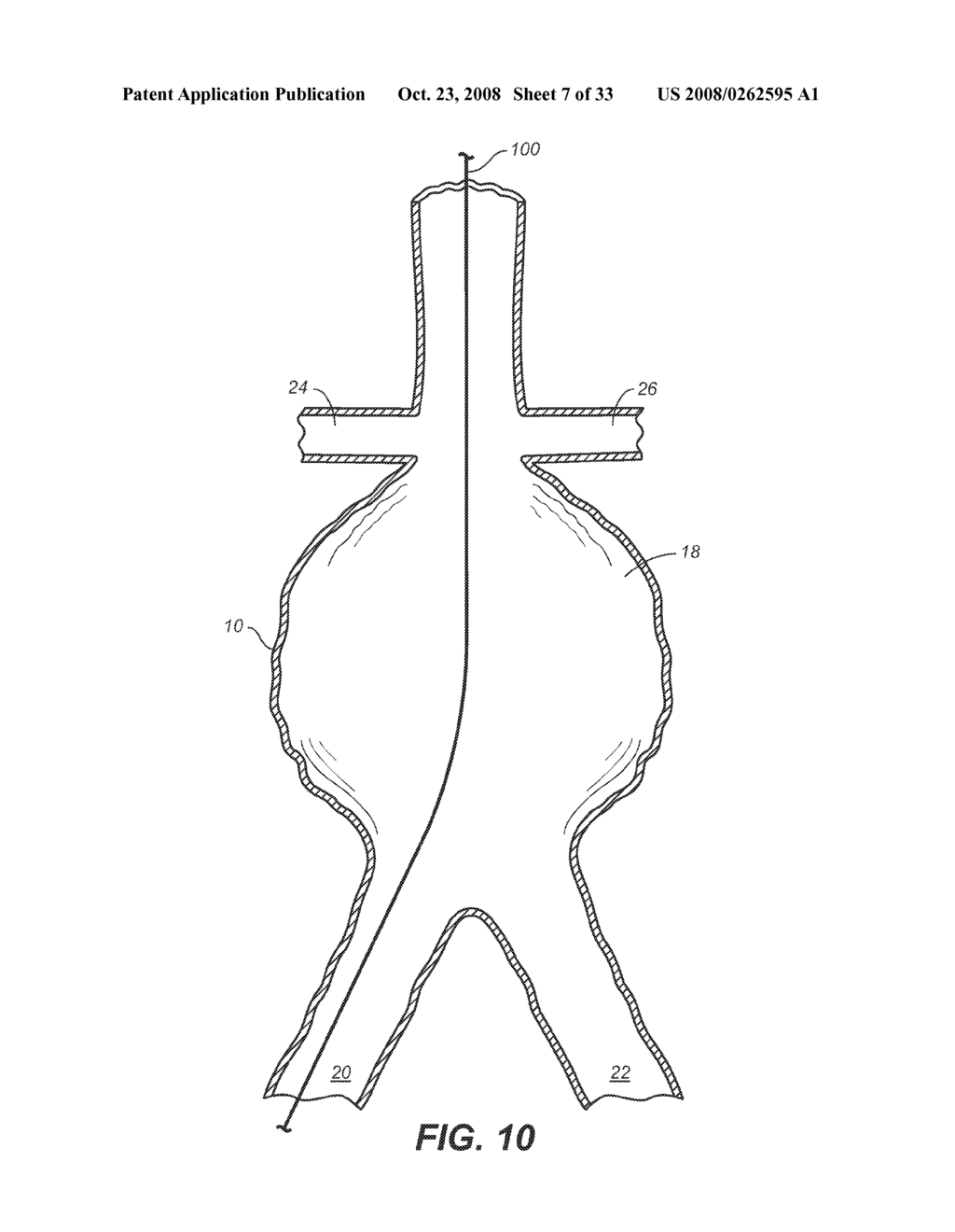 Methods and Apparatus for Treatment of Aneurysms Adjacent to Branch Arteries - diagram, schematic, and image 08