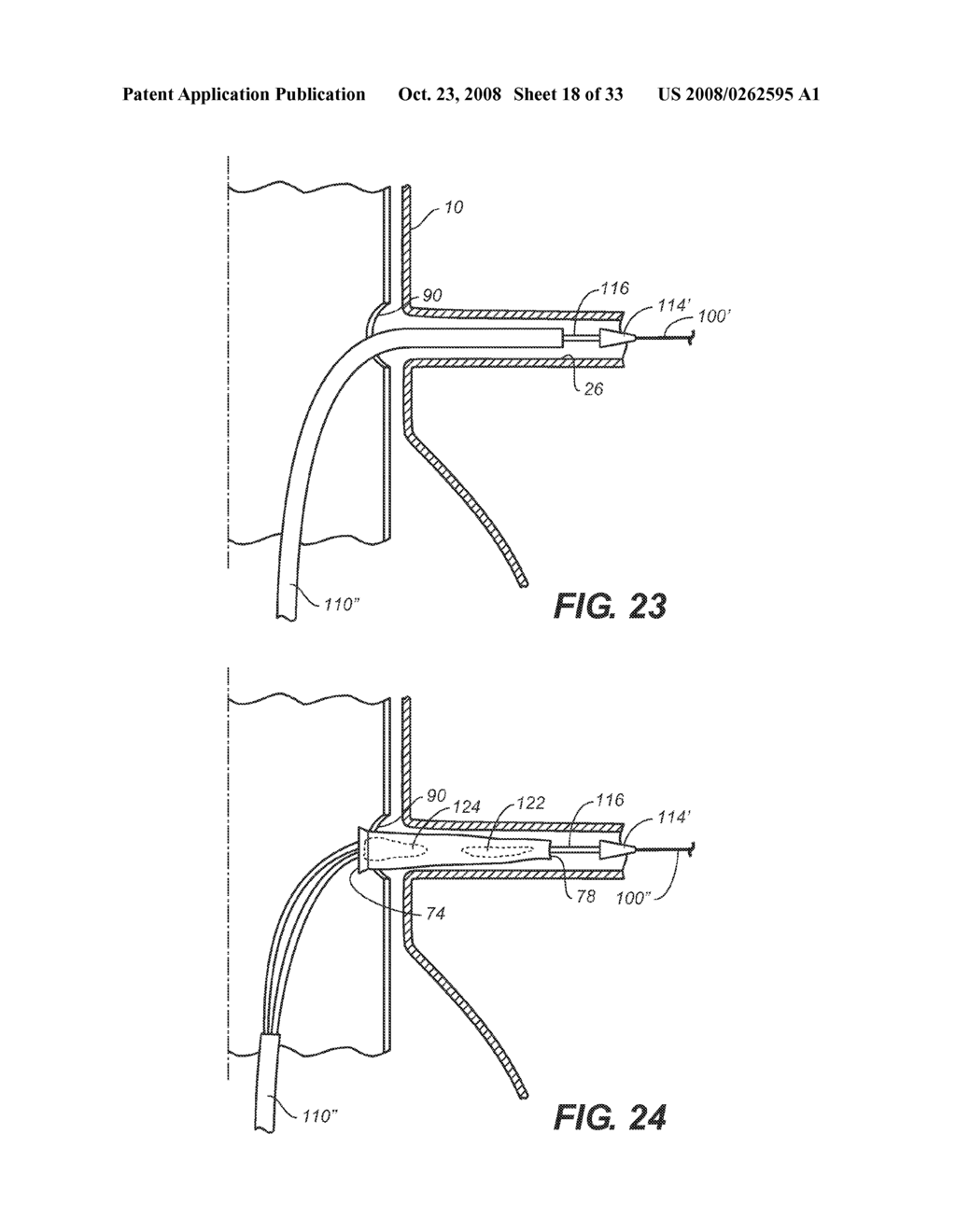 Methods and Apparatus for Treatment of Aneurysms Adjacent to Branch Arteries - diagram, schematic, and image 19