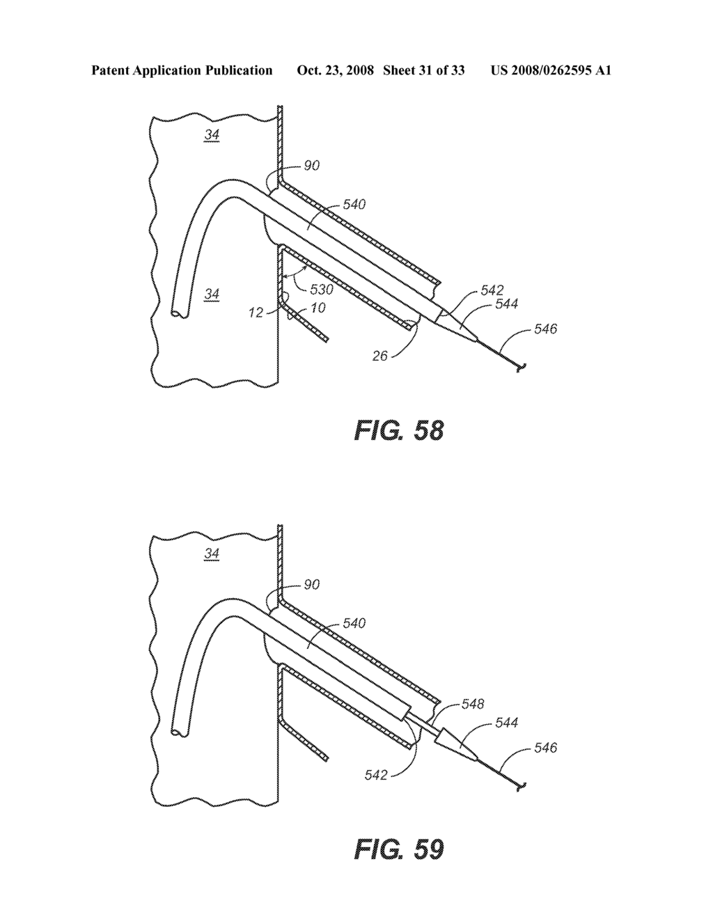 Methods and Apparatus for Treatment of Aneurysms Adjacent to Branch Arteries - diagram, schematic, and image 32