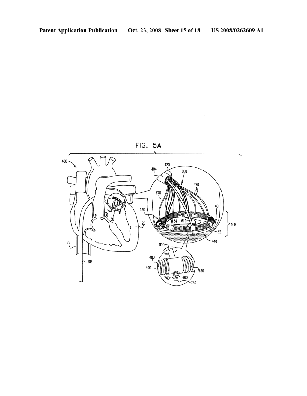 SEGMENTED RING PLACEMENT - diagram, schematic, and image 16