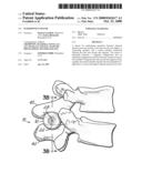 INTERSPINOUS SPACER diagram and image