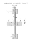 INTERSPINOUS SPACER diagram and image