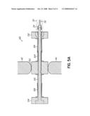 INTERSPINOUS SPACER diagram and image