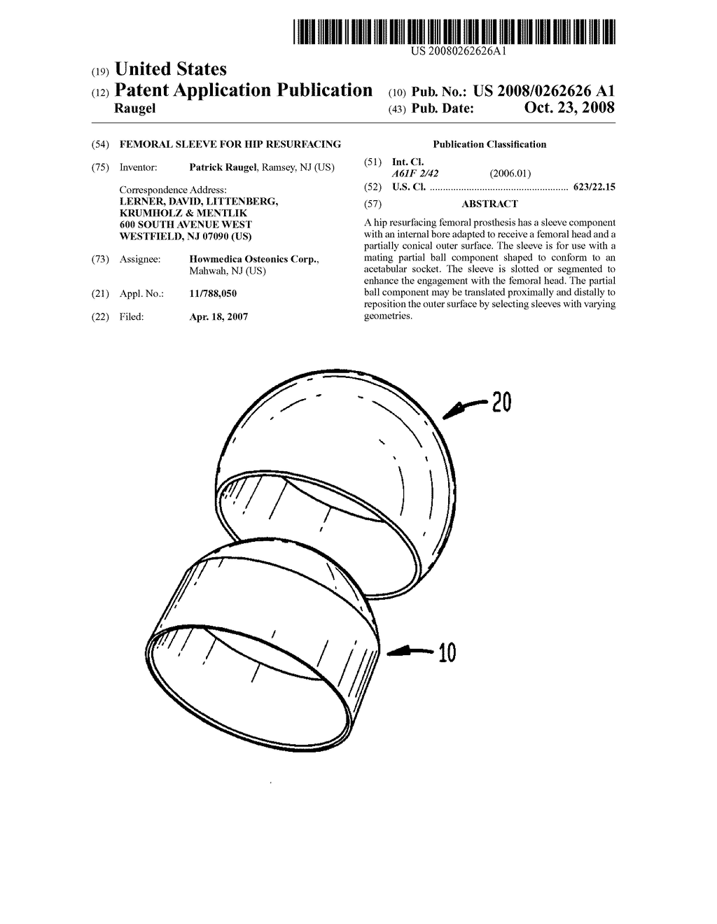 Femoral sleeve for hip resurfacing - diagram, schematic, and image 01