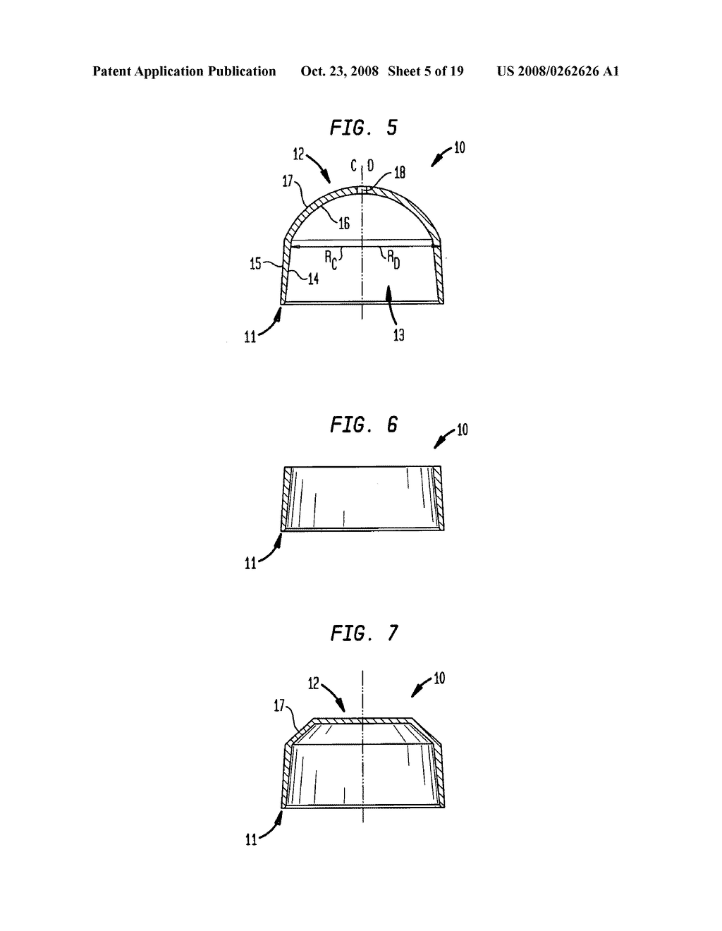 Femoral sleeve for hip resurfacing - diagram, schematic, and image 06