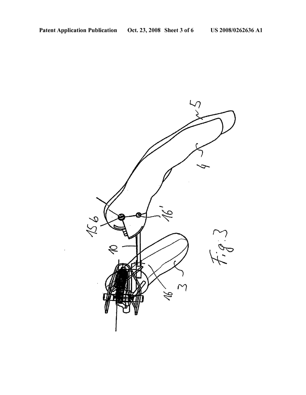 Hand Prosthesis With Fingers That Can Be Aligned in an Articulated Manner - diagram, schematic, and image 04