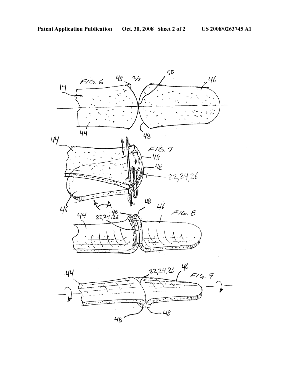 Protective glove - diagram, schematic, and image 03