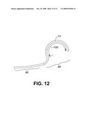 COILED TUBING WITH RETAINER FOR CONDUIT diagram and image