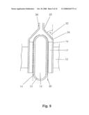 ANODE FOR GAS EVOLUTION REACTIONS diagram and image