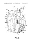 Wetness sensor with audible signal for an absorbent article diagram and image