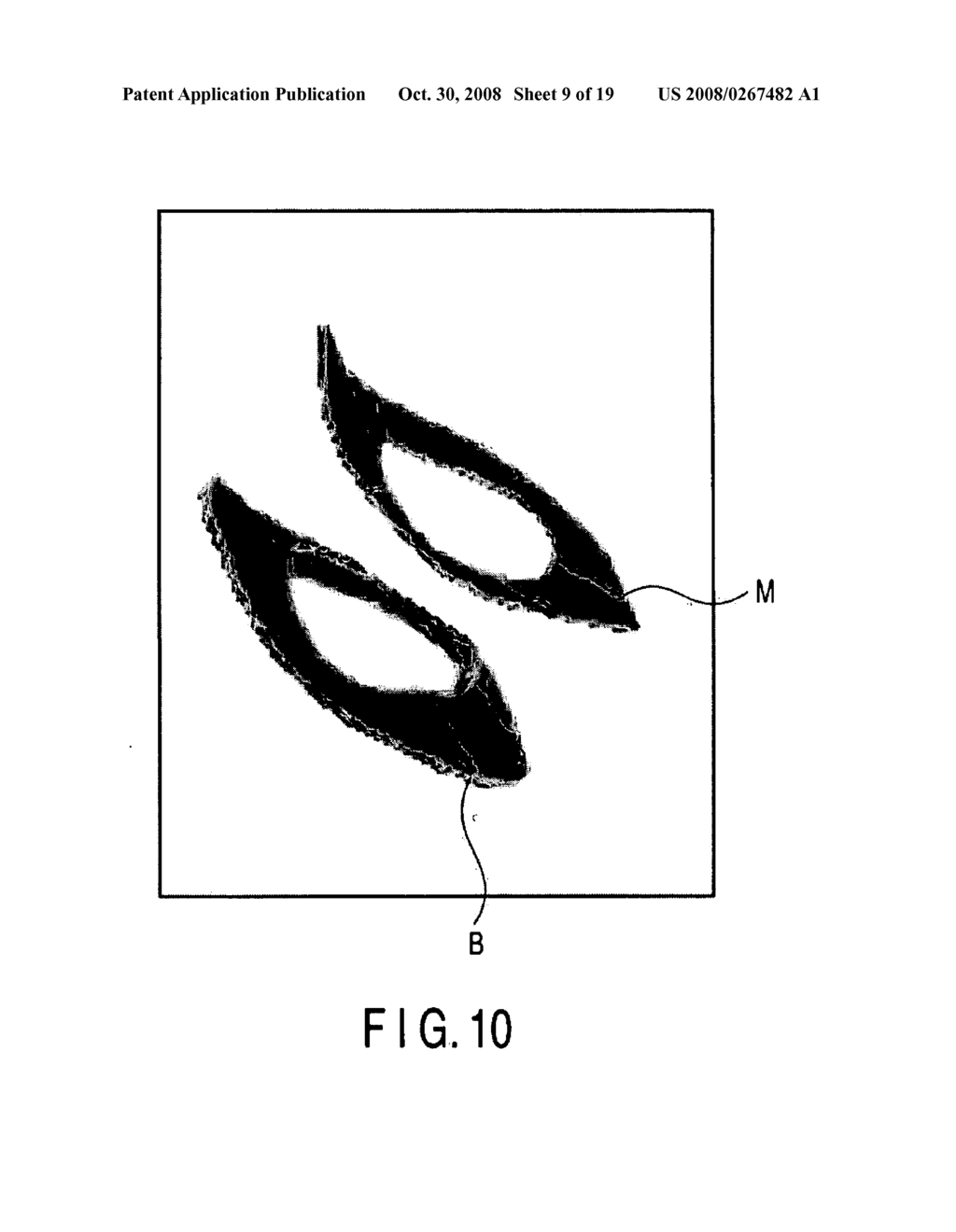 ULTRASONIC IMAGE PROCESSING APPARATUS AND ULTRASONIC IMAGE PROCESSING METHOD - diagram, schematic, and image 10